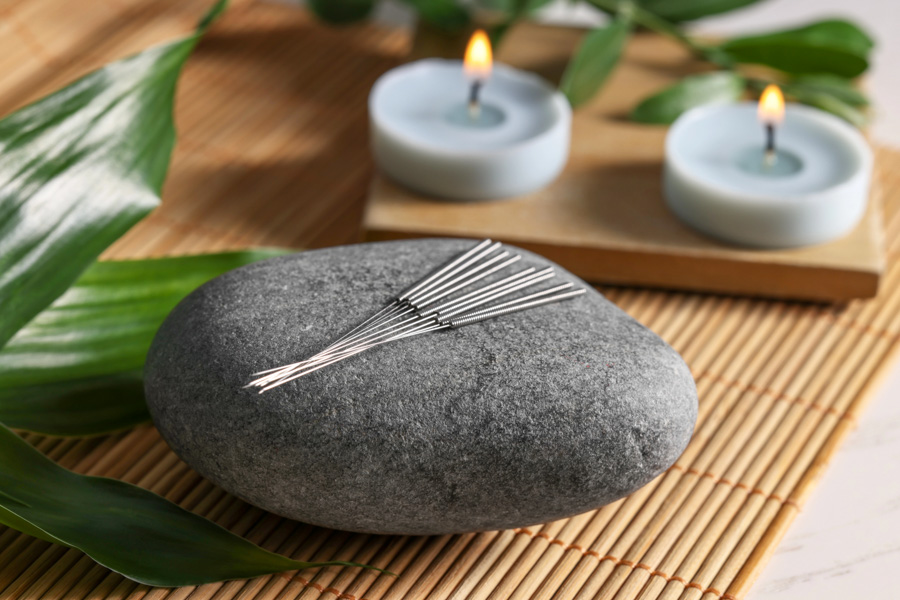 Traditional Chinese Medicine: Acupuncture Needles
